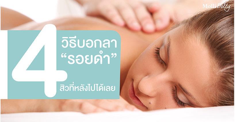 4 วิธี บอกลาสิวที่หลังไปได้เลย 4 วิธี บอกลาสิวที่หลังไปได้เลย