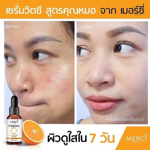 merci vitamin c serum